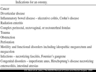 D.E. Beck et al. (eds.), The ASCRS Manual of Colon and Rectal Surgery 2009
 