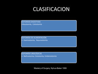 CLASIFICACION
OSTOMIAS DIGESTIVAS
•Ileostomía, Colostomía
OSTOMÍAS DE ALIMENTACIÓN
•: Gastrostomía, Yeyunostomía
OSTOMÍAS UROLÓGICAS
•: Nefrostomía, Cistotomía, Ureterostomía
Mastery of Surgery, Nyhus-Baker 1999
 