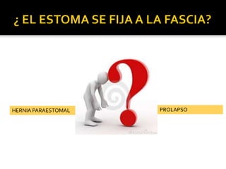 HERNIA PARAESTOMAL PROLAPSO
 