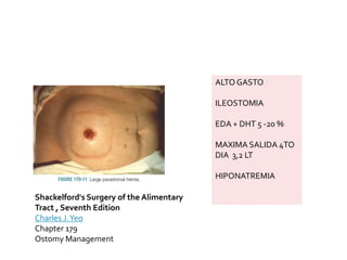 ALTO GASTO
ILEOSTOMIA
EDA + DHT 5 -20 %
MAXIMA SALIDA 4TO
DIA 3,2 LT
HIPONATREMIA
Shackelford's Surgery of the Alimentary
Tract , Seventh Edition
Charles J.Yeo
Chapter 179
Ostomy Management
 