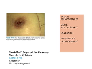 VARICES
PERIOSTOMALES
LIMITE
MUCOCUTANEO
SANGRADO
ENFERMEDAD
HEPATICA GRAVE
Shackelford's Surgery of the Alimentary
Tract , Seventh Edition
Charles J.Yeo
Chapter 179
Ostomy Management
 