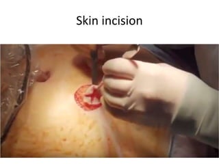 Skin incision