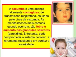 A caxumba é uma doença
altamente contagiosa, de
transmissão respiratória, causada
pelo vírus da caxumba. As
manifestações mais comuns,
quando ocorrem, são febre e
aumento das glândulas salivares
(parotidite). Entretanto, pode
comprometer o sistema nervoso e
raramente resultando em surdez e
esterilidade.
 