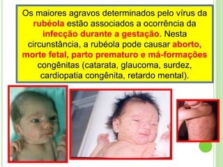 Os maiores agravos determinados pelo vírus da
rubéola estão associados a ocorrência da
infecção durante a gestação. Nesta
circunstância, a rubéola pode causar aborto,
morte fetal, parto prematuro e má-formações
congênitas (catarata, glaucoma, surdez,
cardiopatia congênita, retardo mental).
 