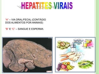 “A” – VIA ORAL/FECAL (CONTÁGIO
DOS ALIMENTOS POR ANIMAIS)
“B” E “C” – SANGUE E ESPERMA
 