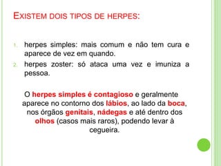 EXISTEM DOIS TIPOS DE HERPES:
1. herpes simples: mais comum e não tem cura e
aparece de vez em quando.
2. herpes zoster: só ataca uma vez e imuniza a
pessoa.
O herpes simples é contagioso e geralmente
aparece no contorno dos lábios, ao lado da boca,
nos órgãos genitais, nádegas e até dentro dos
olhos (casos mais raros), podendo levar à
cegueira.
 