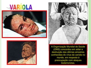 A Organização Mundial de Saúde
(OMS) concordou em adiar a
destruição das últimas amostras
conhecidas do vírus da varíola no
mundo, em resposta à
preocupação com ataques
bioterroristas.
 