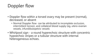 Doppler flow
• Doppler flow within a torsed ovary may be present (normal),
decreased, or absent
• Normal Doppler flow can be attributed to incomplete occlusion,
intermittent torsion, and collateral blood supply (eg, utero-ovarian
vessels, infundibulopelvic vessels
• Whirlpool sign - a round hyperechoic structure with concentric
hypoechoic stripes or a tubular structure with internal
heterogeneous echoes.
4/17/2023 case presentation on adnexal torsion 30
 