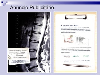 Anúncio Publicitário 