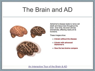 The Brain and AD
An Interactive Tour of the Brain & AD
 