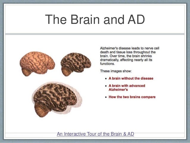 fact of apraxia speech sheet OT 537 dementia