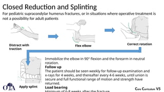 Forearm Rotation Splinting ota_Fractures of the Distal Humerus.pptx