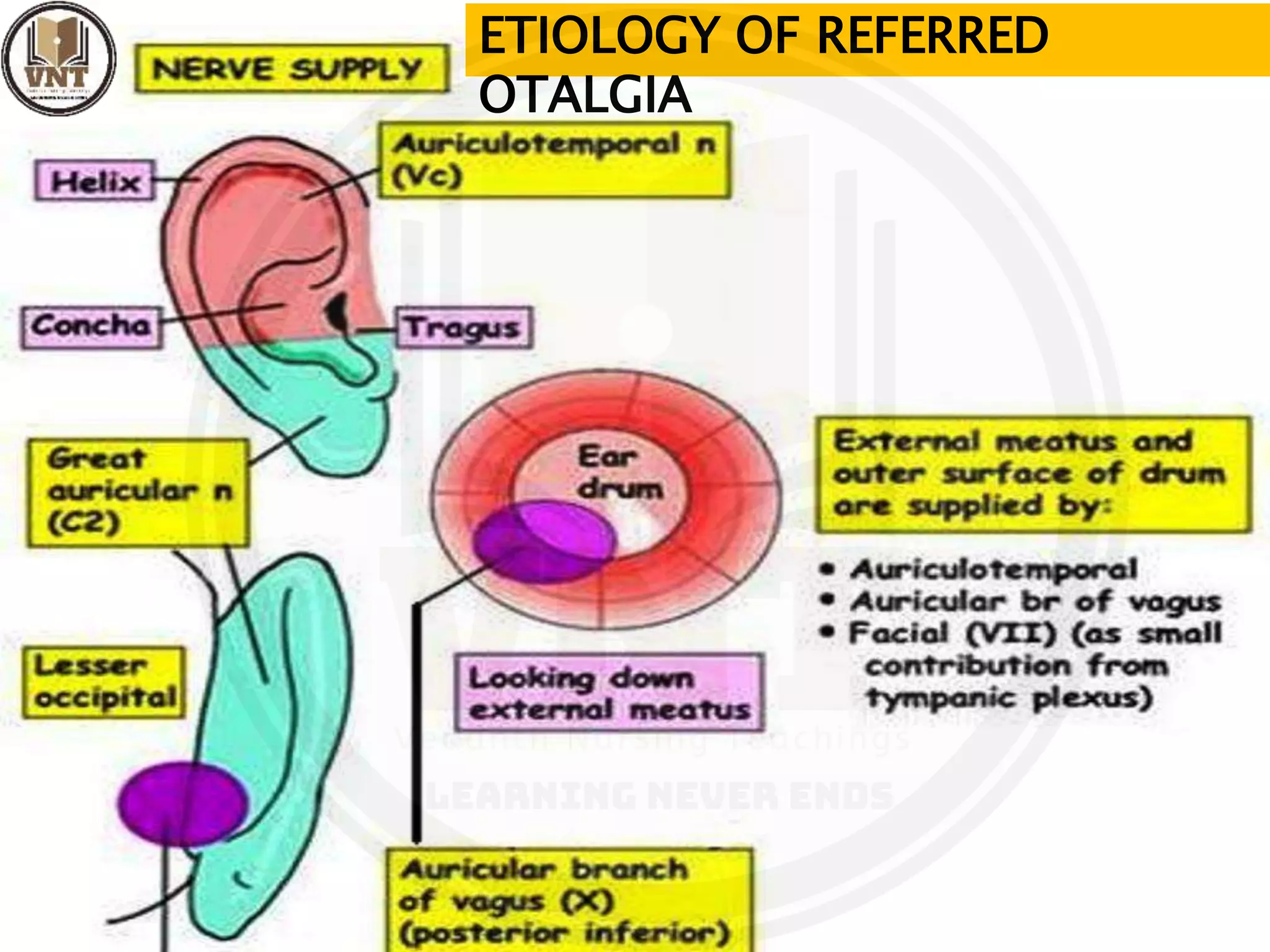 Otalgia | PPT