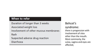 Behcet’s
syndrome:
there is progression with
involvement of sites
other than the mouth.
Most commonly, the
vulva, vagina and eyes are
affected,
 