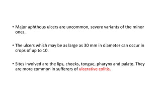 • Major aphthous ulcers are uncommon, severe variants of the minor
ones.
• The ulcers which may be as large as 30 mm in diameter can occur in
crops of up to 10.
• Sites involved are the lips, cheeks, tongue, pharynx and palate. They
are more common in sufferers of ulcerative colitis.
 