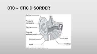 OTC – OTIC DISORDER
 