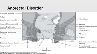 Anorectal Disorder
 