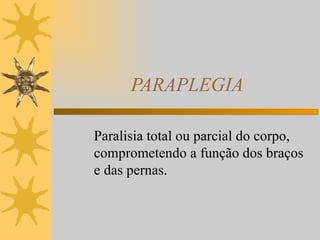 PARAPLEGIA Paralisia total ou parcial do corpo, comprometendo a função dos braços  e das pernas.  