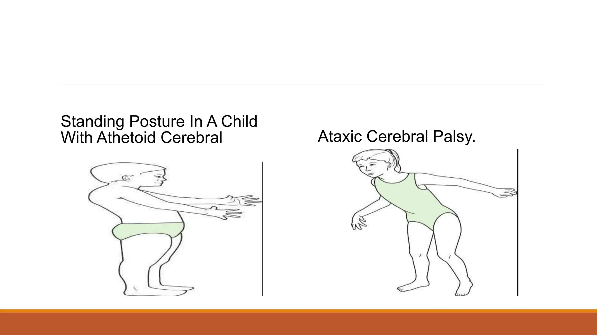 OT for CEREBRAL PALSY-1.pptx