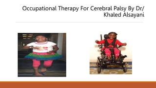 Occupational Therapy For Cerebral Palsy By Dr/
Khaled Alsayani
 
