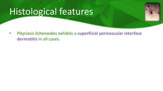 Histological features 
• Pityriasis lichenoides exhibits a superficial perivascular interface 
dermatitis in all cases. 
 
