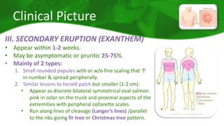 Clinical Picture 
III. SECONDARY ERUPTION (EXANTHEM) 
• Appear within 1-2 weeks. 
• May be asymptomatic or pruritic 25-75%. 
• Mainly of 2 types: 
1. Small rounded papules with or w/o fine scaling that ↑ 
in number & spread peripherally. 
2. Similar lesions to herald patch but smaller (1-2 cm): 
• Appear as discrete bilateral symmetrical oval salmon 
pink in color on the trunk and proximal aspects of the 
extremities with peripheral collarette scales. 
• Run along lines of cleavage (Langer’s lines) /parallel 
to the ribs giving fir tree or Christmas tree pattern. 
 