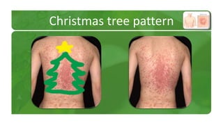 Christmas tree pattern 
 