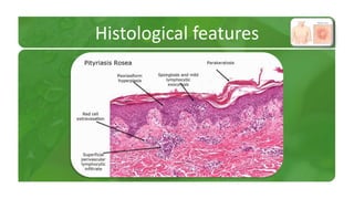 Histological features 
 