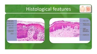 Histological features 
 