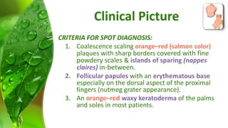 Clinical Picture 
CRITERIA FOR SPOT DIAGNOSIS: 
1. Coalescence scaling orange–red )salmon color) 
plaques with sharp borders covered with fine 
powdery scales & islands of sparing (nappes 
claires) in-between. 
2. Follicular papules with an erythematous base 
especially on the dorsal aspect of the proximal 
fingers (nutmeg grater appearance). 
3. An orange–red waxy keratoderma of the palms 
and soles in most patients. 
 