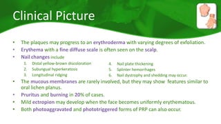 Clinical Picture 
• The plaques may progress to an erythroderma with varying degrees of exfoliation. 
• Erythema with a fine diffuse scale is often seen on the scalp. 
• Nail changes include 
1. Distal yellow-brown discoloration 
2. Subungual hyperkeratosis 
3. Longitudinal ridging 
4. Nail plate thickening 
5. Splinter hemorrhages 
6. Nail dystrophy and shedding may occur. 
• The mucous membranes are rarely involved, but they may show features similar to 
oral lichen planus. 
• Pruritus and burning in 20% of cases. 
• Mild ectropion may develop when the face becomes uniformly erythematous. 
• Both photoaggravated and phototriggered forms of PRP can also occur. 
 