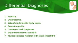 Differential Diagnoses 
1. Psoriasis. 
2. Erythroderma. 
3. Seborrheic dermatitis (Early cases). 
4. Dermatomyositis. 
5. Cutaneous T-cell lymphoma. 
6. Erythrokeratodermia variabilis 
7. Kawasaki disease (Children with acute-onset PRP). 
 