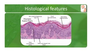 Histological features 
 