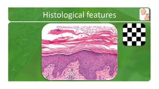 Histological features 
 
