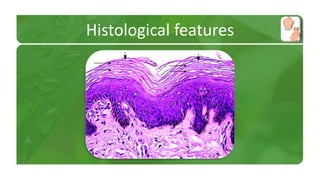 Histological features 
 