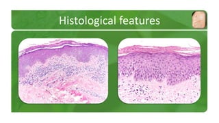 Histological features 
 