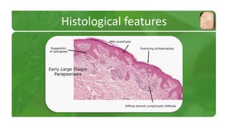 Histological features 
 