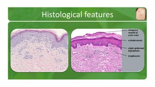 Histological features 
 