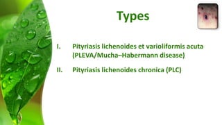 Types 
I. Pityriasis lichenoides et varioliformis acuta 
(PLEVA/Mucha–Habermann disease) 
II. Pityriasis lichenoides chronica (PLC) 
 
