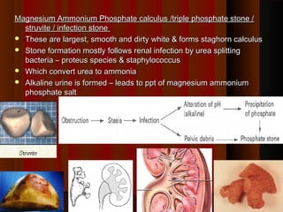 Magnesium Ammonium Phosphate calculus /triple phosphate stone /Magnesium Ammonium Phosphate calculus /triple phosphate stone /
struvite / infection stonestruvite / infection stone
 These are largest, smooth and dirty white & forms staghorn calculusThese are largest, smooth and dirty white & forms staghorn calculus
 Stone formation mostly follows renal infection by urea splittingStone formation mostly follows renal infection by urea splitting
bacteria – proteus species & staphylococcusbacteria – proteus species & staphylococcus
 Which convert urea to ammoniaWhich convert urea to ammonia
 Alkaline urine is formed – leads to ppt of magnesium ammoniumAlkaline urine is formed – leads to ppt of magnesium ammonium
phosphate saltphosphate salt
2020
 