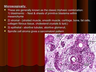 MicroscopicallyMicroscopically
 These are generally known as the classic triphasic combination:These are generally known as the classic triphasic combination:
1) blastmemic - Nest & sheets of primitive blastema within1) blastmemic - Nest & sheets of primitive blastema within
mesenchymemesenchyme
 2) stromal - (straited muscle, smooth muscle, cartilage, bone, fat cells,2) stromal - (straited muscle, smooth muscle, cartilage, bone, fat cells,
collagen fibrous tissue, cholesterol crystals & lipid,)collagen fibrous tissue, cholesterol crystals & lipid,)
 3) epithelial - abortive tubules, abortive glomeruli,3) epithelial - abortive tubules, abortive glomeruli,
 Spindle cell stroma gives a sarcomatoid patternSpindle cell stroma gives a sarcomatoid pattern
3939
 