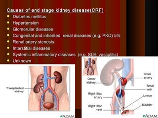 Causes of end stage kidney disease(CRF)Causes of end stage kidney disease(CRF)
 Diabetes mellitusDiabetes mellitus
 HypertensionHypertension
 Glomerular diseasesGlomerular diseases
 Congenital and inherited renal diseases (e.g. PKD) 5%Congenital and inherited renal diseases (e.g. PKD) 5%
 Renal artery stenosisRenal artery stenosis
 Interstitial diseasesInterstitial diseases
 Systemic inflammatory diseases (e.g. SLE, vasculitis)Systemic inflammatory diseases (e.g. SLE, vasculitis)
 UnknownUnknown
4747
 