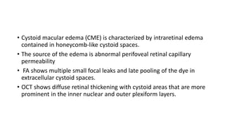 • Cystoid macular edema (CME) is characterized by intraretinal edema
contained in honeycomb-like cystoid spaces.
• The source of the edema is abnormal perifoveal retinal capillary
permeability
• FA shows multiple small focal leaks and late pooling of the dye in
extracellular cystoid spaces.
• OCT shows diffuse retinal thickening with cystoid areas that are more
prominent in the inner nuclear and outer plexiform layers.
 