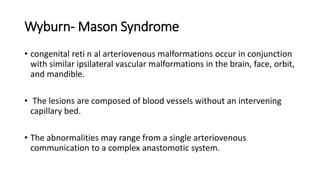 Wyburn- Mason Syndrome
• congenital reti n al arteriovenous malformations occur in conjunction
with similar ipsilateral vascular malformations in the brain, face, orbit,
and mandible.
• The lesions are composed of blood vessels without an intervening
capillary bed.
• The abnormalities may range from a single arteriovenous
communication to a complex anastomotic system.
 