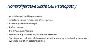 Nonproliferative Sickle Cell Retinopathy
• Arteriolar and capillary occlusion
• Anastomosis and remodeling of vasculature
• Salmon- patch hemorrhages
• Refractile spots
• Black “sunburst” lesions
• Occlusion of parafoveal capillaries and arterioles
• Spontaneous occlusion of the central retinal artery may also develop in patients
with sickle cell hemoglobinopathies.
 