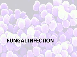 FUNGAL INFECTION
 