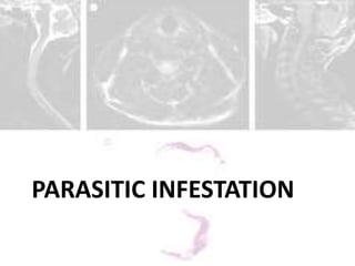 PARASITIC INFESTATION
 
