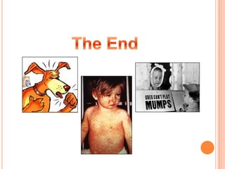 What clinical characteristics of this case were diagnostic for measles? 