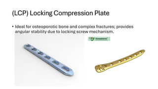 Orthopedic Implants for the surgeries of femur radius and ulna | PDF