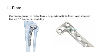 Orthopedic Implants for the surgeries of femur radius and ulna | PDF
